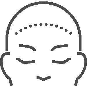 lowering-hair-line-treatment-jakarta-hair-transplant-centre