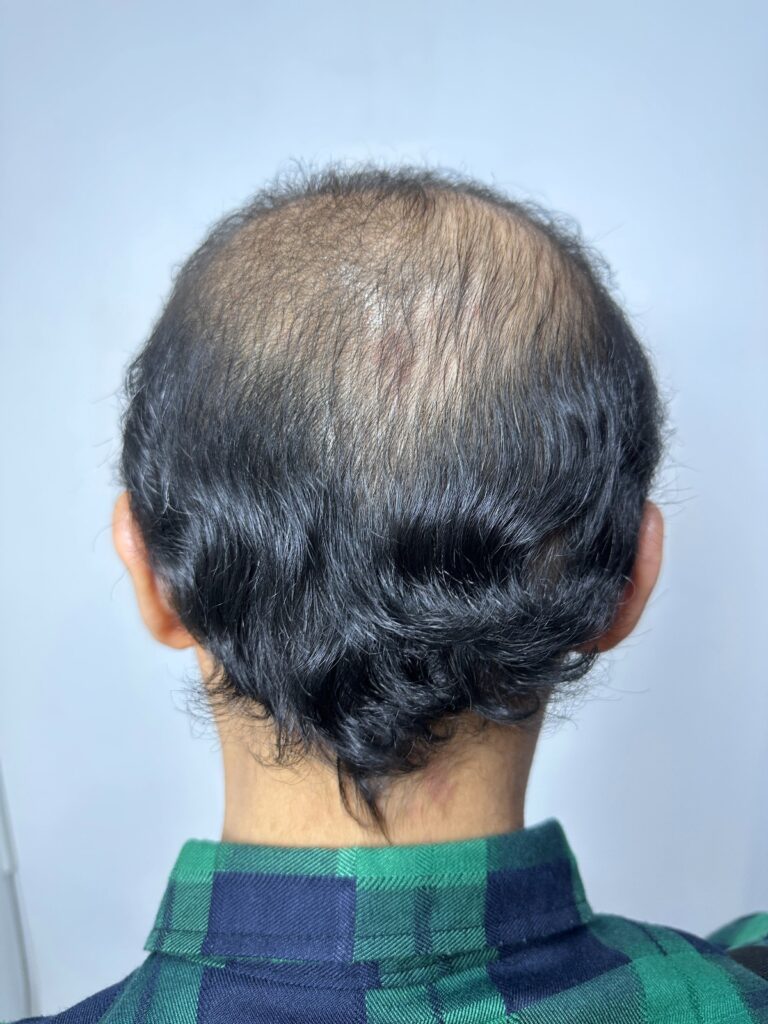results-after