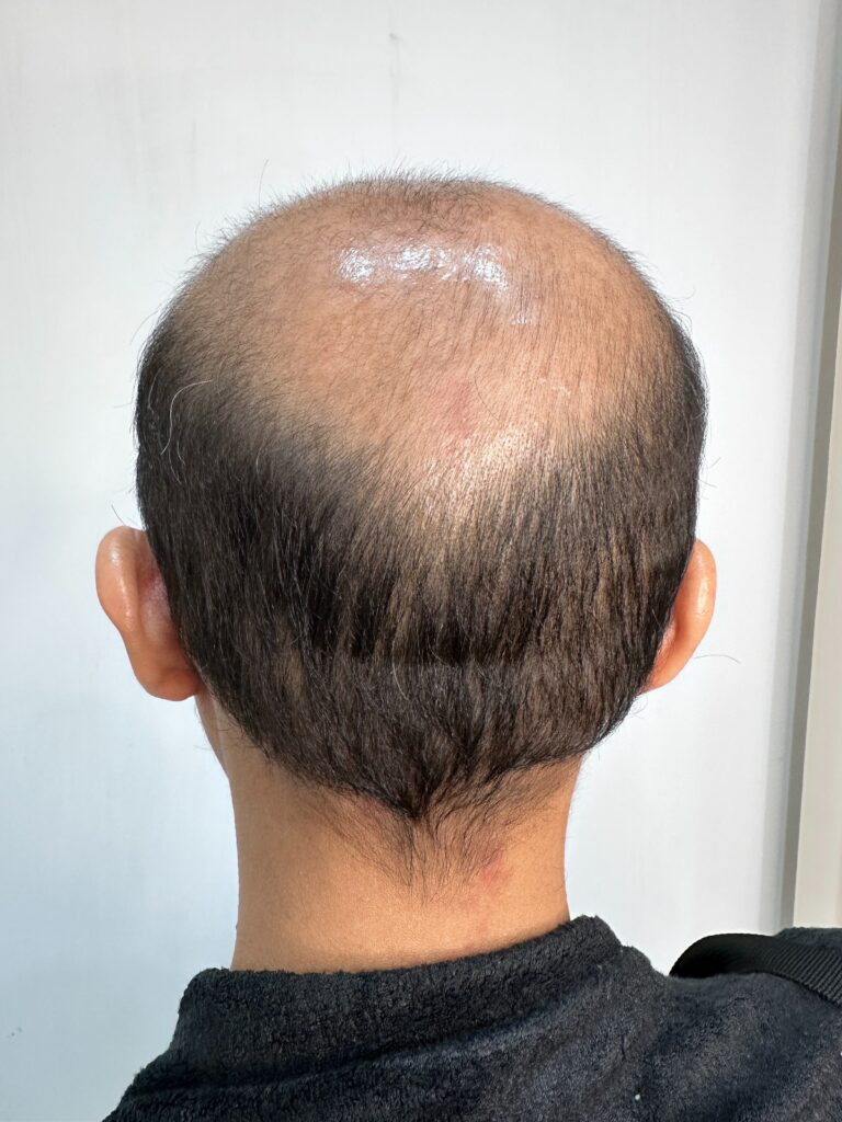 results-before