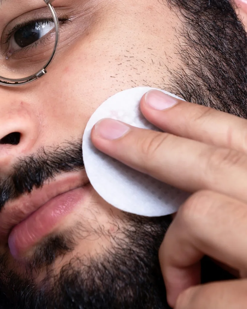 kenapa-beard-transplant-image-tanam-rambut-jakarta-hair-transplant-centre